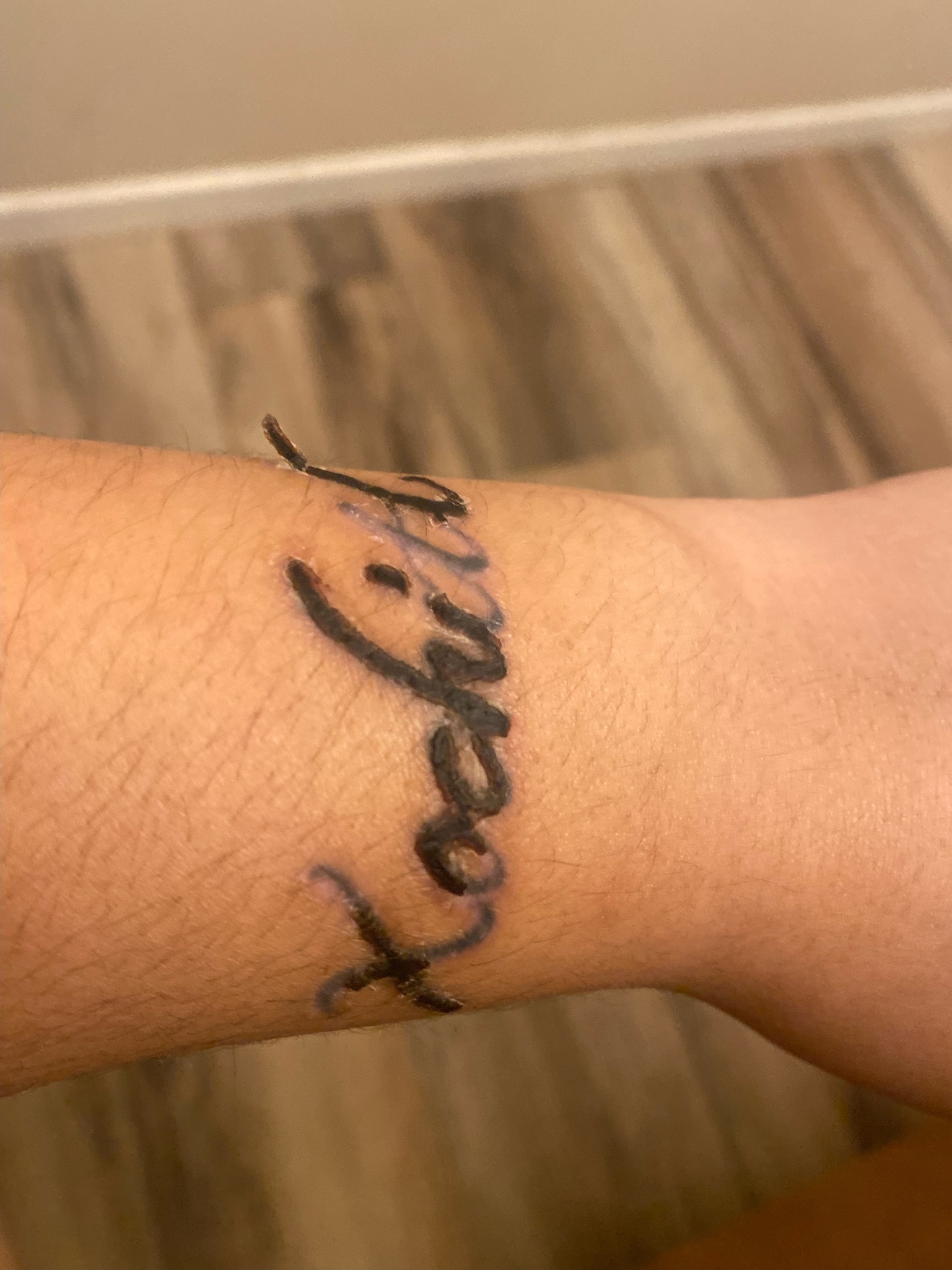 What is Non-Laser Tattoo Removal